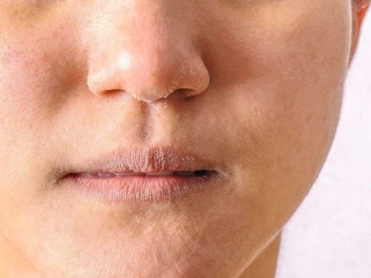 Da chưa được cấp ẩm đầy đủ thì đánh nền kiểu gì cũng dễ mốc