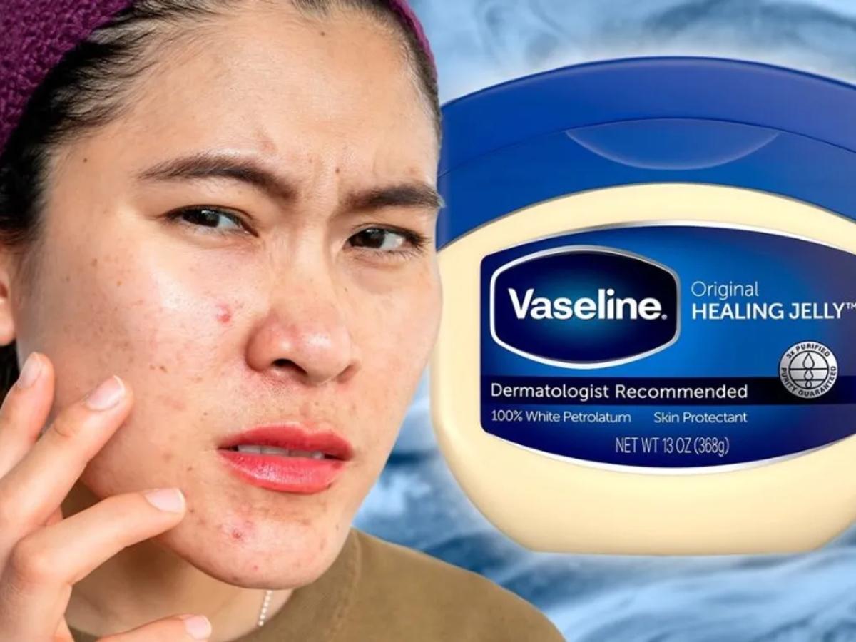 Nhược điểm khi thực hiện tẩy trang bằng Vaseline 