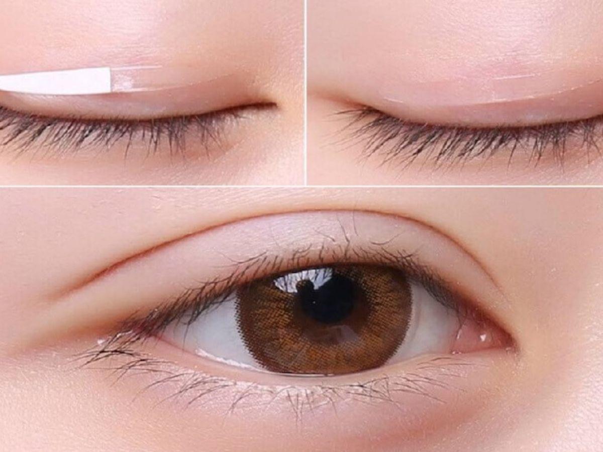 Kích mí giúp đôi mắt trở nên to tròn