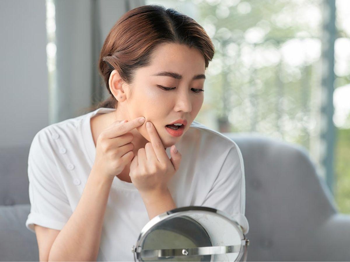 Tuyệt đối không tự nặn mụn tại nhà