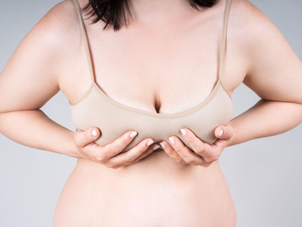 Sự giãn hoặc đứt dây chằng khiến vòng 1 bị chảy xệ