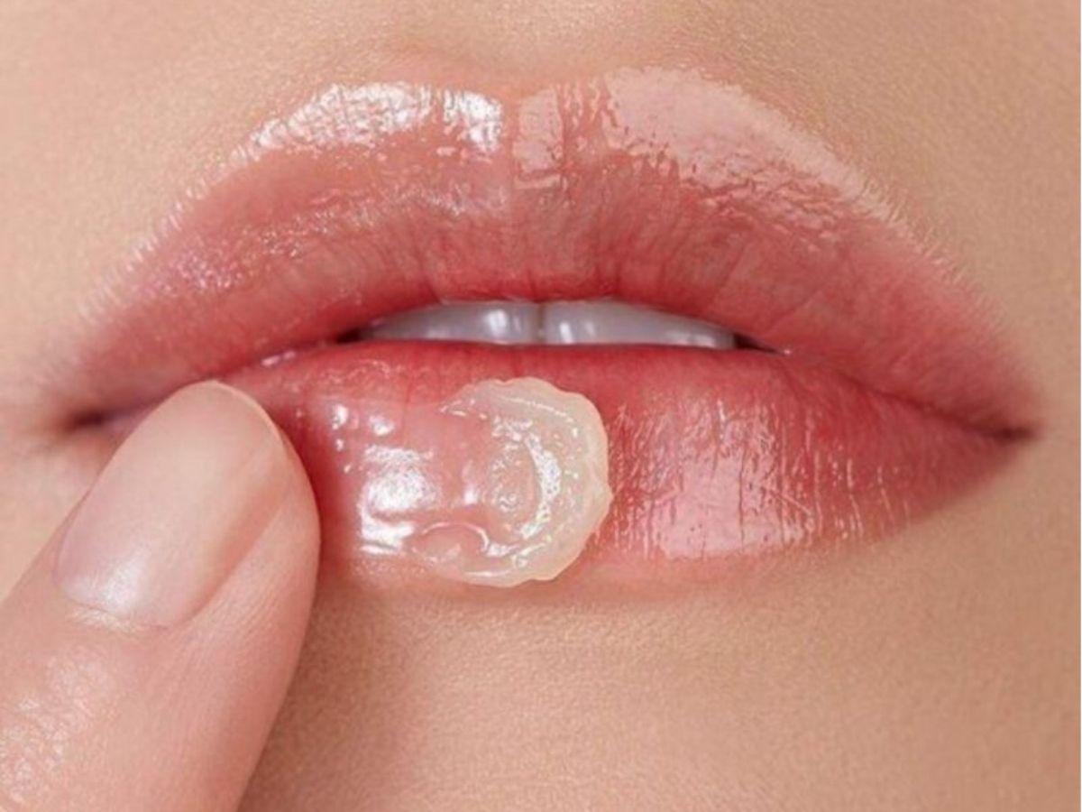 Bị dị ứng son môi nên bôi thuốc gì?