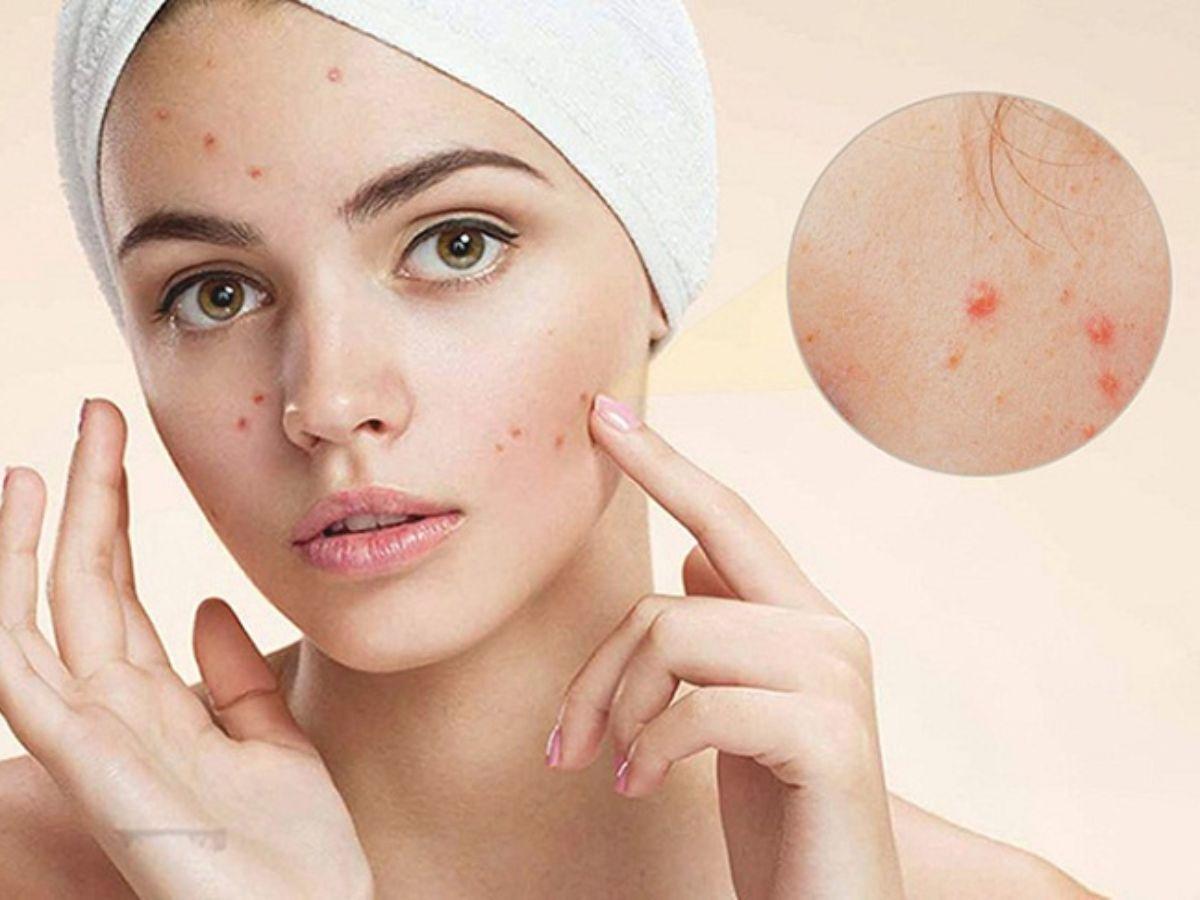 Kích thước hạt phấn rôm thường lớn hơn so với hạt phấn phủ chuyên dụng được bào chế riêng cho da mặt