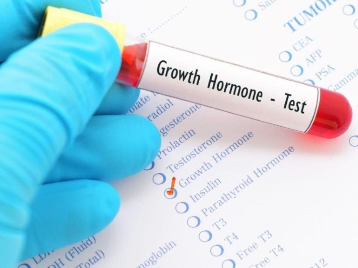 HIIT có thể kích thích hormone tăng trưởng tự nhiên