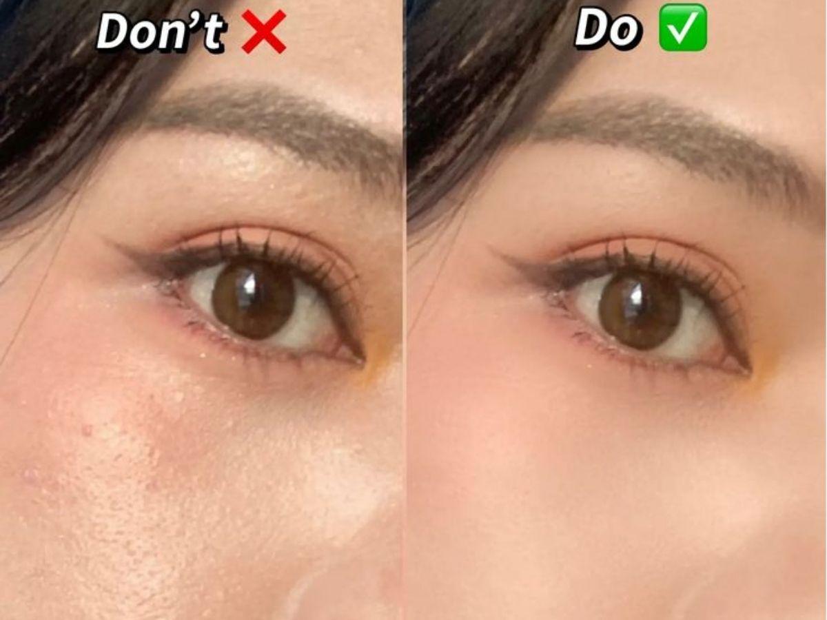 Đặc điểm da khô và lý do lớp nền thường bị mốc