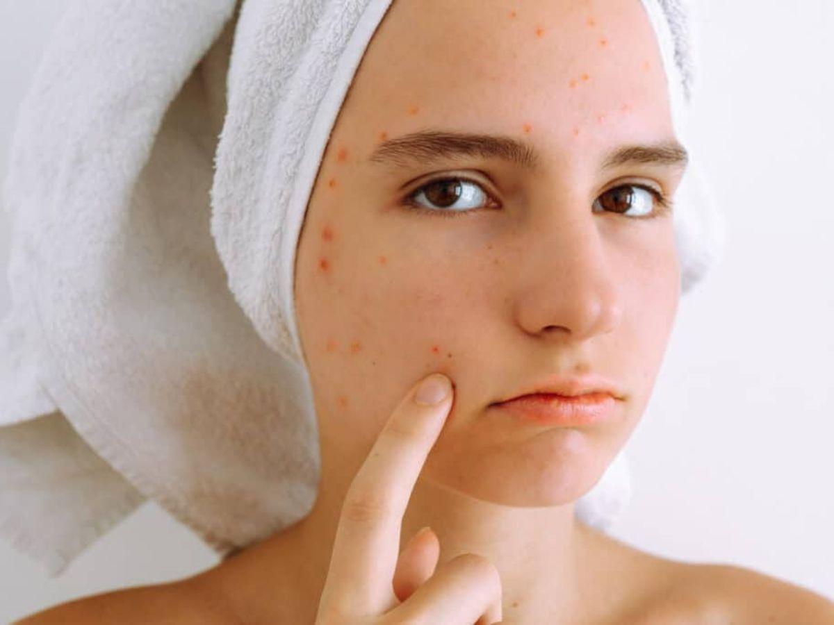 Phấn nước có thể gây bí da, nổi mụn nếu bạn chọn loại không hợp với da