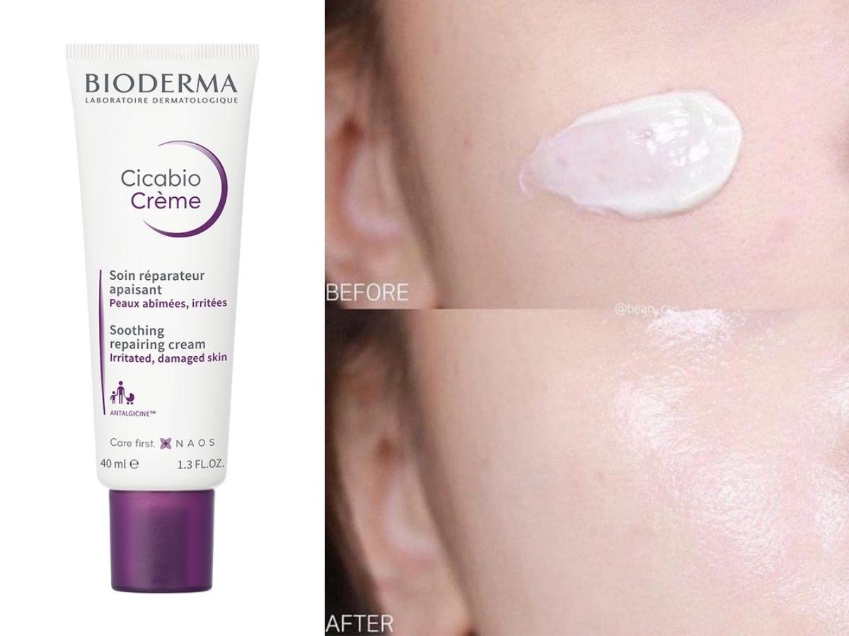 Bioderma Cicabio Crème là lựa chọn hoàn hảo cho da sau tổn thương
