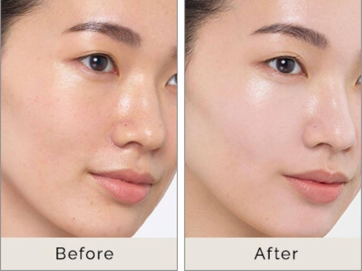Ảnh trước và sau khi sử dụng kem lót