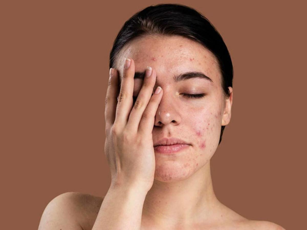 Nguyên nhân và dấu hiệu của làn da nhạy cảm 