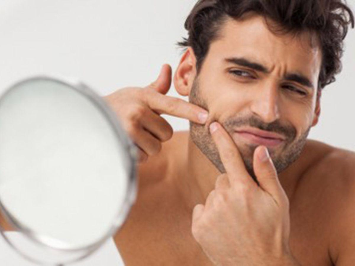 Nhận diện và tránh những sai lầm này là bước quan trọng để trị mụn đầu đen thành công