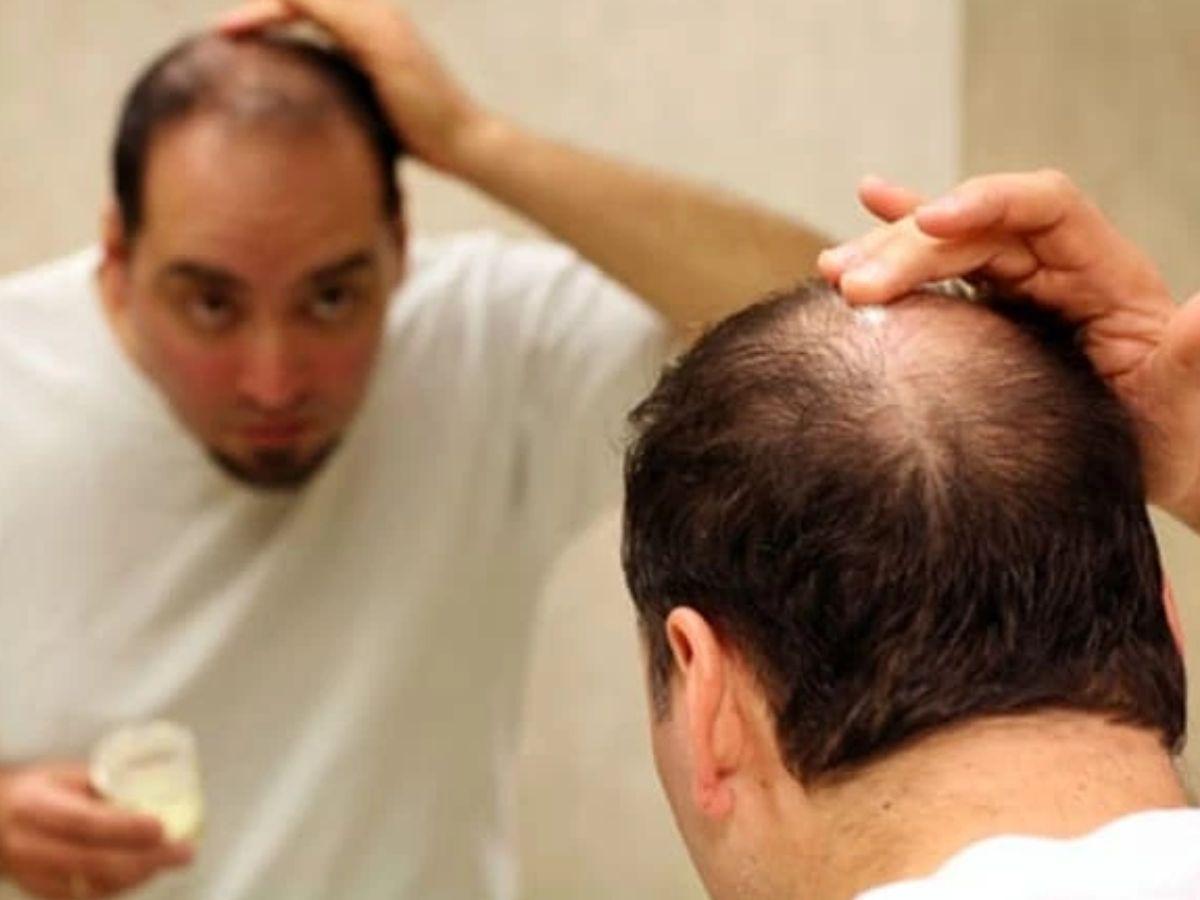 Cần sử dụng kiên trì từ ít nhất 3-6 tháng để có thể thấy sự cải thiện về tóc