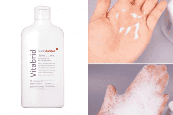 Vitabrid - Dầu gội rụng tóc cho nam