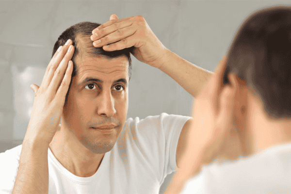 Rụng tóc khi gội đầu ở nam giới, nguyên nhân do đâu?