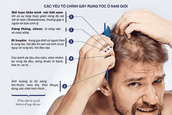 Có rất nhiều nguyên nhân dẫn đến tình trạng rụng tóc khi gội đầu ở nam giới
