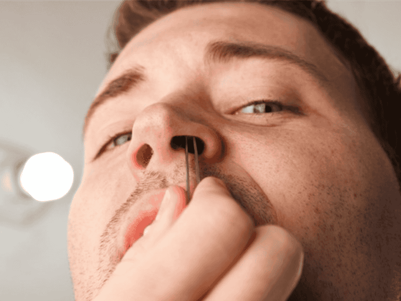 Hạn chế sử dụng nhíp để nhổ lông mũi (Nguồn: TintucOnline)