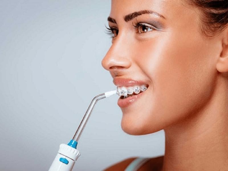 Thích hợp cho những người đang niềng răng