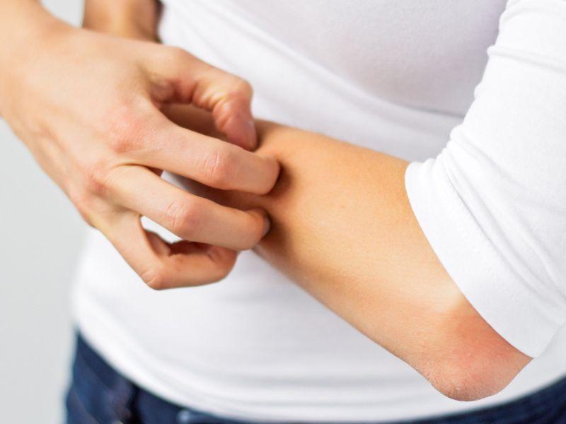 Mặc áo ẩm mốc bị ngứa