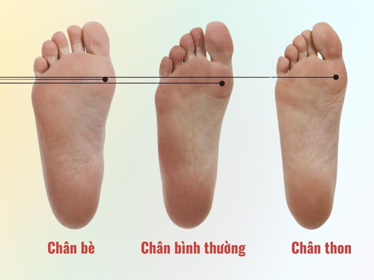 Cách nhận biết chân bè đơn giản tại nhà
