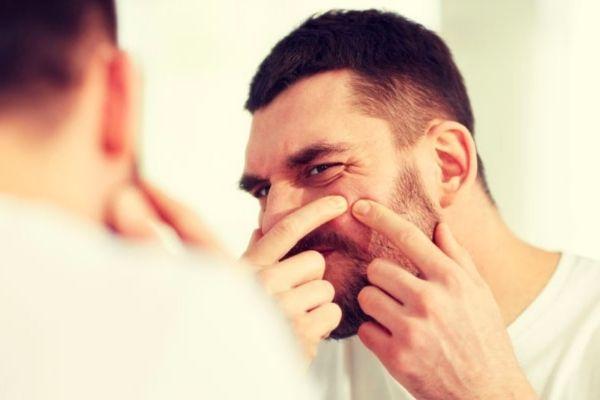 Nặn mụn chỉ khiến da mụn thêm trầm trọng mà thôi