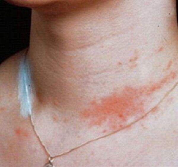 Tác hại của trang sức mỹ ký