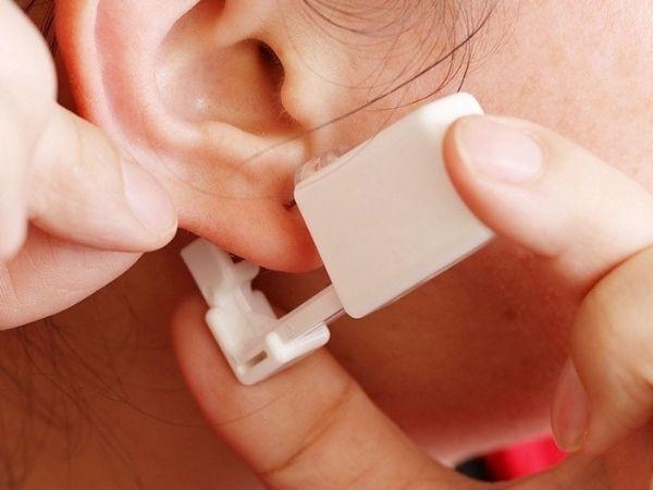 Hạn chế tháo, xê dịch khuyên tai tạm thời