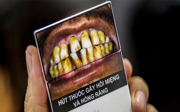 Thuốc lá gây hôi miệng